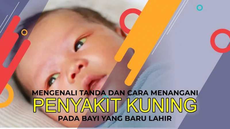 Mengenali Tanda dan Cara Menangani Penyakit Kuning pada Bayi Baru Lahir